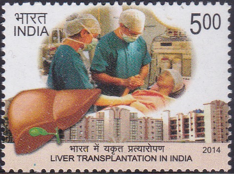  Liver Transplantation in India