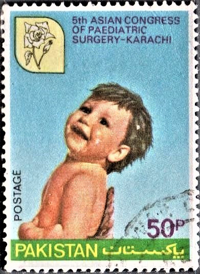  Pakistan on Paediatric Surgery 1980